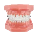 ┬®DynaFlex-Norris Clear Typodont.webp
