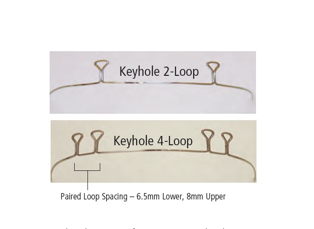 SS Keyhole 4 Loop