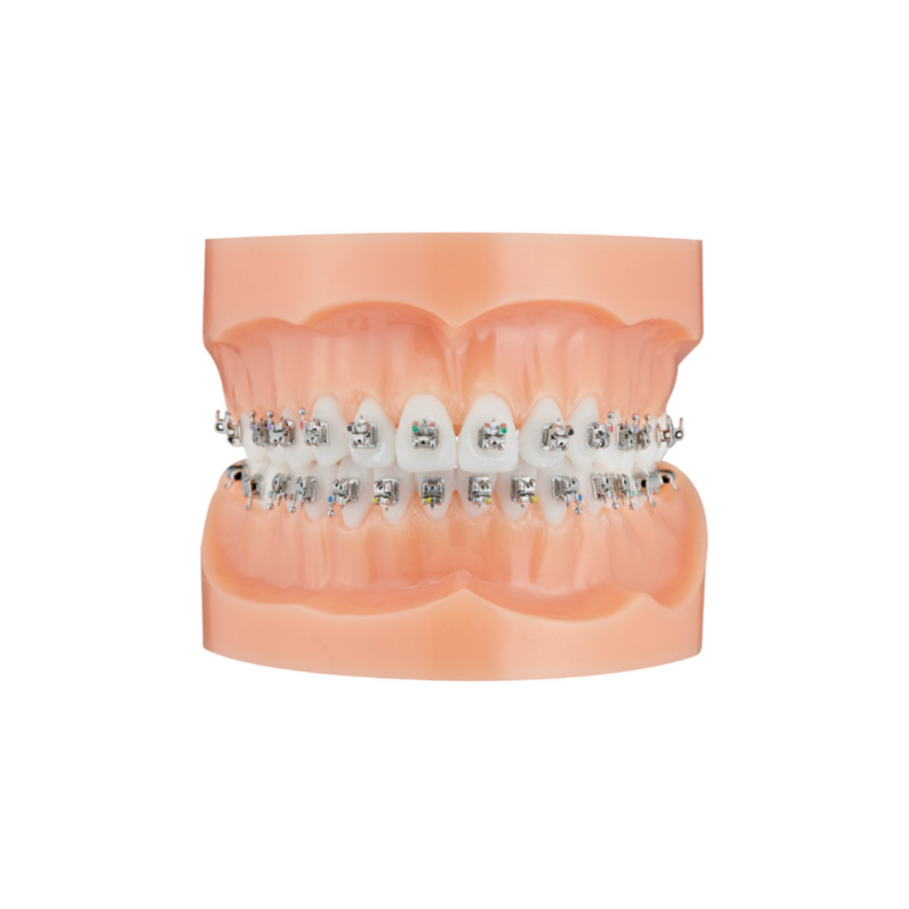 Bracket autoligaturant metalic Majesty MBT .022