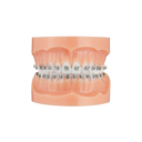 Bracket autoligaturant metalic Majesty MBT .022