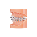 Bracket autoligaturant metalic Majesty MBT .022