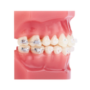 Set bracketi safir ClearViz+mini .022