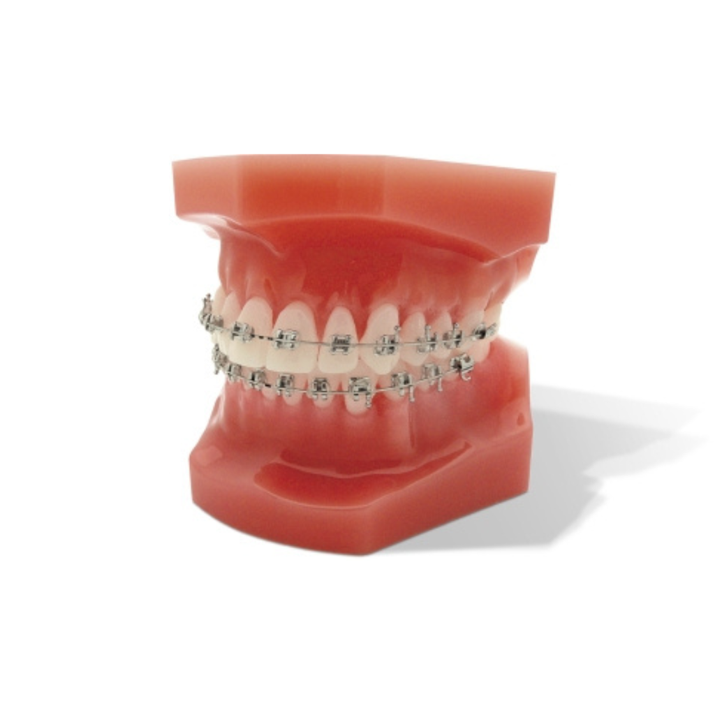 Set bracketi metalici miniPrevail .018