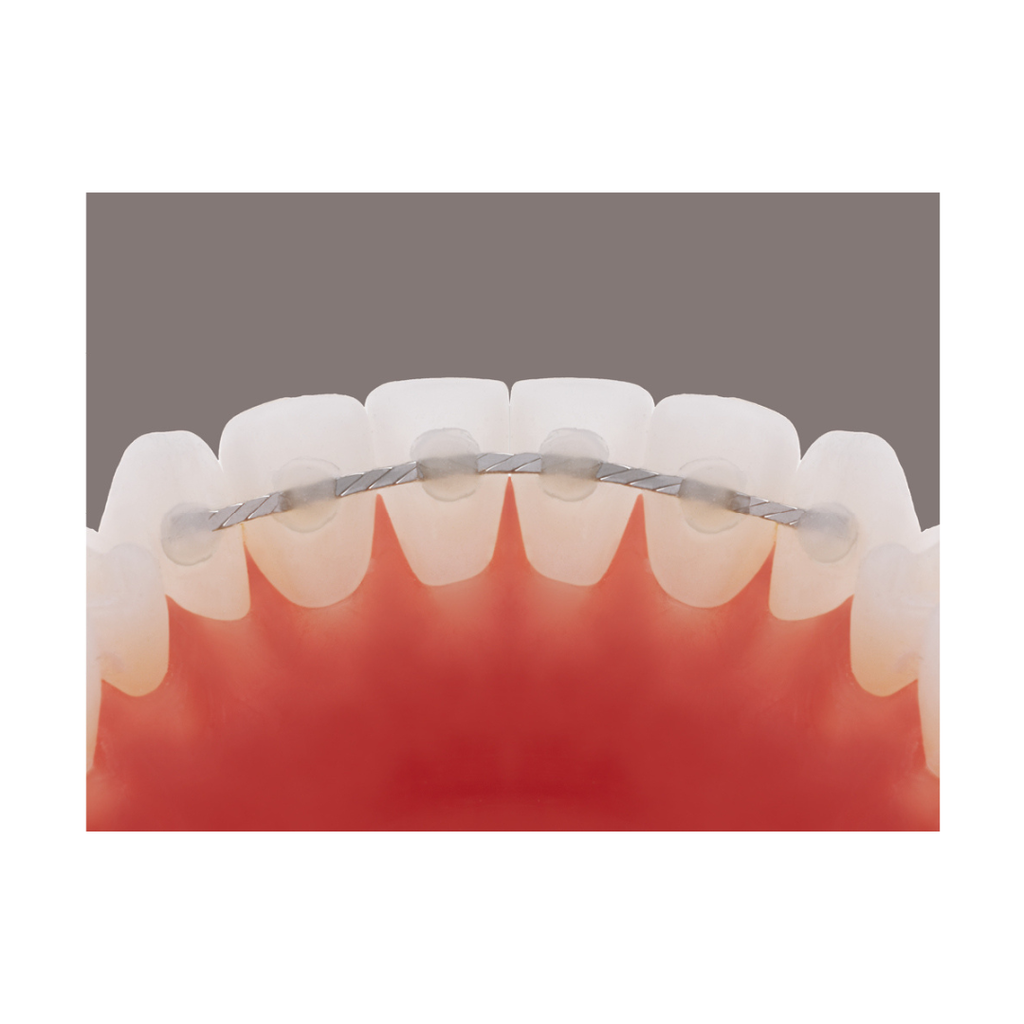 Retainer lingual Retainium TMA