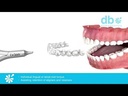 youtube - [Video]