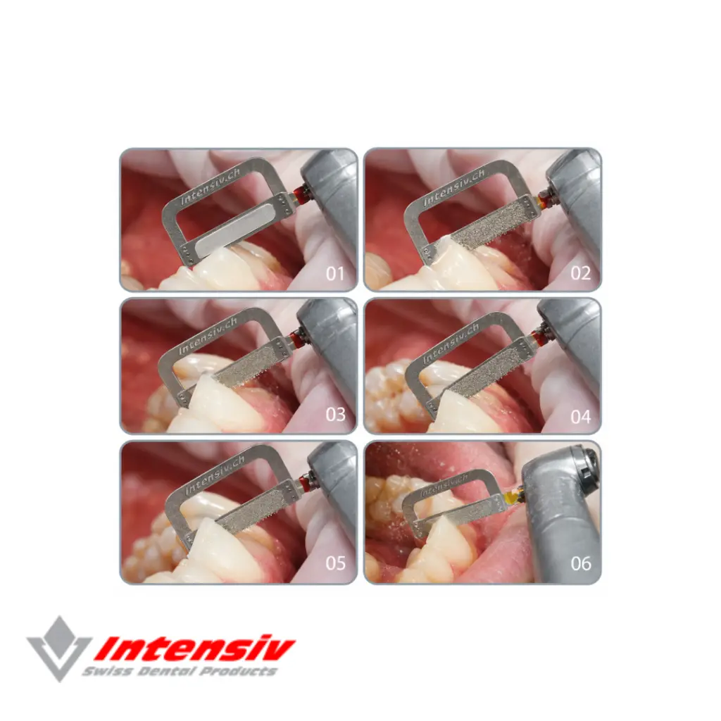 ortho strips central 2.webp