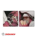 intensiv (3).webp