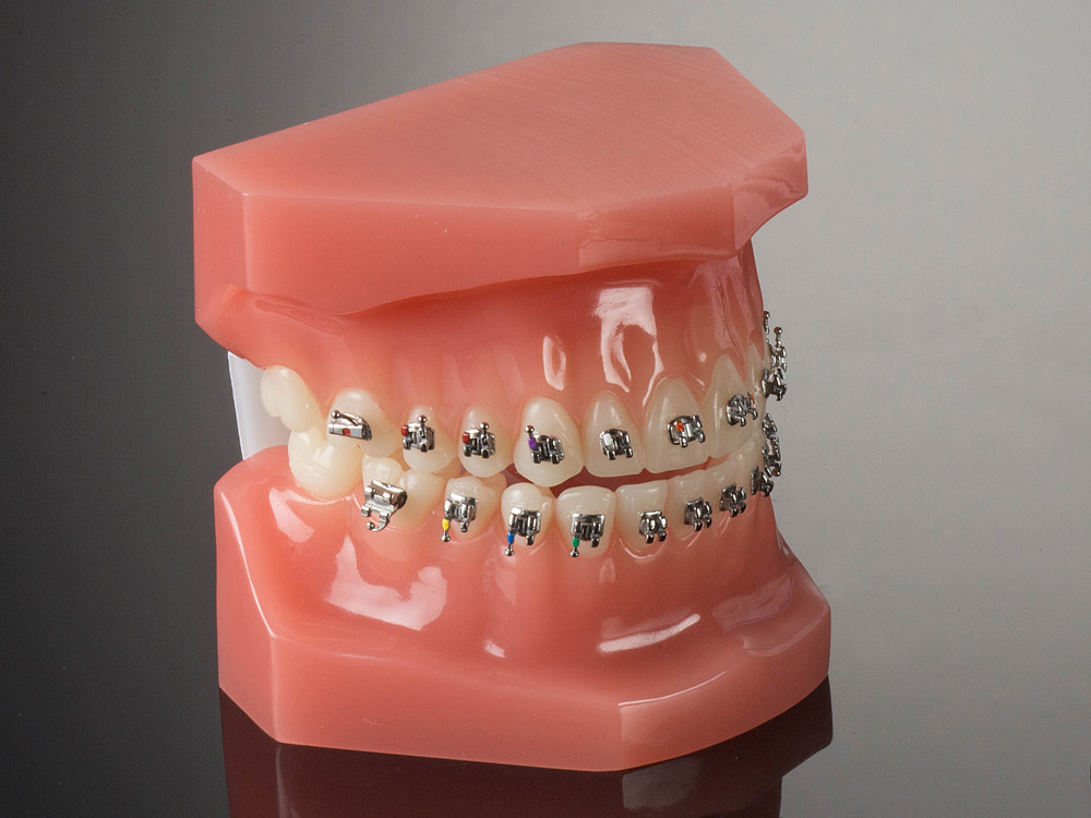 miniPrevail Roth .022 Refill